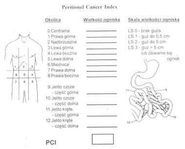 Peritoneal Cancer Index